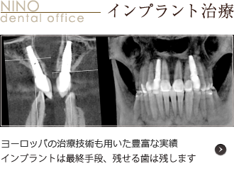 インプラント治療