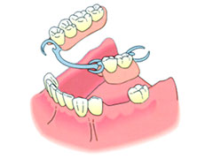 入れ歯