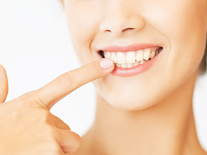 歯ぐきのラインを美しくする歯周病治療
